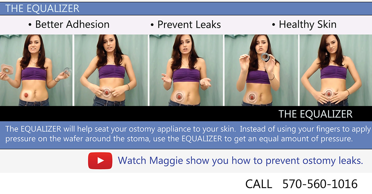 Ostomy Leakage