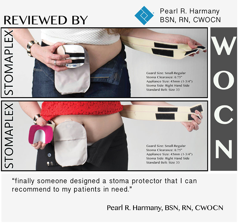 Stomaplex Ostomy Belt and Stoma Guard: Men and women with an ostomy benefit from the Stomaplex Ostomy Belt. This stoma guard protects the stoma of an ostomy for increased confidence. Ostomy Belt: Stoma Belt and Stoma Guard for all ostomy bags and ostomy types such as ileostomy, colostomy, and urostomy. Protect your ostomy stoma with a stoma guard belt by Stomaplex.